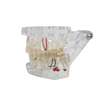 Стоматологичен Прозрачен модел на зъбите Демонстрация на Кацане на ноктите Модел на учебна практика, за да общуват с медицински пациенти